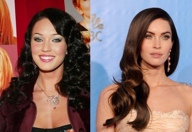 Grandes celebridades antes e depois das plásticas